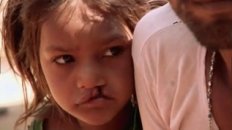 Smile Pinki - Documentary Trailer